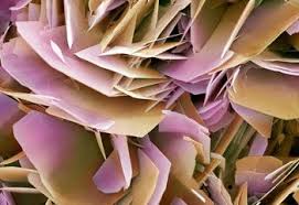 Here Is The Reason Why Kidney Stones Are So Painful One Under A Microscope Things Under A Microscope Microscopic Microscopic Photography