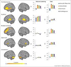 Language Related Domain Specific And Domain General Systems In The Human Brain Sciencedirect