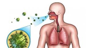 Virus ini hanya menyerang manusia dan kera saja. Kenali Ciri Ciri Demam Yang Disebabkan Virus Corona Sesak Nafas Hingga Menjadi Pneumonia Serambi Indonesia