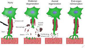 Differentiate into schwann cell precursors. The Role Of Schwann Cells In Peripheral Nerve Function Injury And Repair Springerlink
