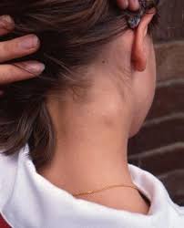 Pin On Medical Holistic Natural