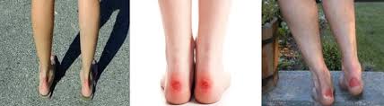 When shoes rub our ankle, it will result in a painful act. 7 Tips To Stop Shoes From Rubbing Your Ankle Back Achilles