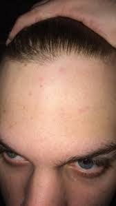 Pin On Its All Hair