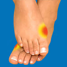 Maybe you would like to learn more about one of these? Bunions Hallux Valgus Relieve Foot Pain Leg Pain