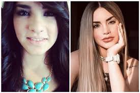 Shein kimberly loaiza capucha bajo asimétrico con cremallera. Las Cirugias Plasticas A Las Que Se Ha Sometido Kimberly Loaiza Tu En Linea