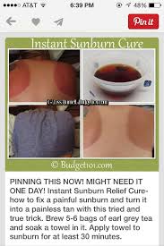 How To Get Rid Of A Sunburn Immediately Cure For Sunburn Sunburn Relief Sunburn
