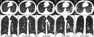 Covid clinic has 58 testing sites in california, arizona, nevada, oregon, utah, and washington. Ct Provides Best Diagnosis For Novel Coronavirus Covid 19 Imaging Technology News