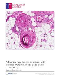 Martorell hypertensive ischemic leg ulcer: Pdf Pulmonary Hypertension In Patients With Martorell Hypertensive Leg Ulcer A Case Control Study