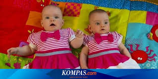 Check spelling or type a new query. Meski Kembar Dua Bayi Ini Lahir Berselang 2 Bulan