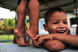 food security » GCP Blog