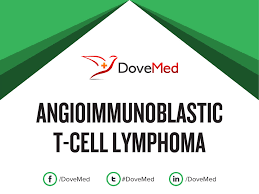 Angioimmunoblastic t cell lymphoma microenvironment. Angioimmunoblastic T Cell Lymphoma