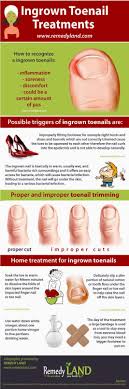 Pin On Health Infographics