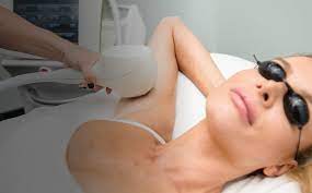 Watch this video to learn what to expect prior to and after your treatment. Ipl Hair Removal Vs Laser Hair Removal What S The Difference Tay Medispa