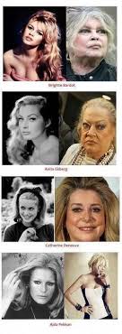 Ajda Pekkan Plastic Surgery Balding Cosmetic Surgery