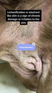 Image result for scrotum dog skin peeling