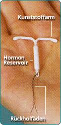 Die prozedur ist relativ einfach, verursacht wenig bis keine schmerzen und hat sehr wenige nebenwirkungen. Dr Med Markus Hunold Verhutung Hormonspirale Vaginalring Verhutungspflaster