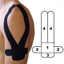 Kindmax Kinesiology Tape In 2021 Kinesiology Taping Kinesiology Physio Tape