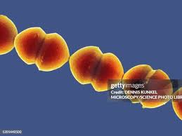 Image result for Group D Streptococcus