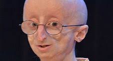Morto a 17 anni Sam Berns, il ragazzino che ha commosso il mondo