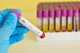 Check spelling or type a new query. How To Get Rid Of Mono Causes Symptoms And Treatment