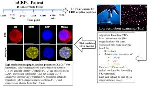 Prostate cancer continues to grow even when the amount of testosterone in the body is reduced to a very low level. Quantitative Analysis Of Taxane Drug Target Engagement Of Microtubules In Circulating Tumor Cells From Metastatic Castration Resistant Prostate Cancer Patients Treated With Crxl301 A Nanoparticle Of Docetaxel