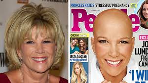 Former Good Morning America Host Joan Lunden Takes Off Her Wig On People Magazine Cover Abc7 New York