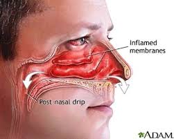Clear A Stuffed Nose Or Relieve Sinus Pressure By Pushing Your Tongue Against The Roof Of Your Mouth Then Pressing A Finger Between Your Eyebrows Remedy For Sinus Congestion Sinus Infection