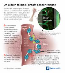 Sometimes people with metastatic breast cancer do not have any of these changes. Cancer S Spread To Bone National Cancer Institute