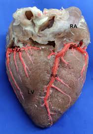 Surface anatomy and features of the heart and the pericardium the pericardium: Posterior View Of The Heart Lv Left Ventricle Ra Right Atrium Rca Download Scientific Diagram