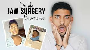 My Full Jaw Surgery Story 2016