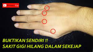 Sakit gigi itu sendiri memang merupakan salah jika sakit gigi karena gigi sudah berlubang besar. Dalam 10 Menit Sakit Gigi Hilang Hanya Dengan Pijatan Ini Youtube