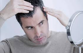 Nutritional deficiencies like vitamin b12 deficiency, severe iron deficiency, chronic protein loss, copper deficiency are often found associated with premature greying of hairs. No More Greys Deccan Herald