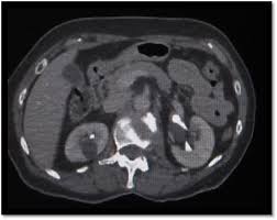 Scanning of a single organ, such as the liver or the pancreas, at multiple times during the rapid. Epos C 1289