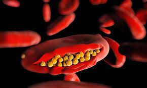 Malaria is a disease that is transmitted from person to person by infected mosquitoes. Learning From The Hydroxychloroquine Mistake Qps