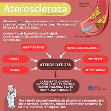 La cardiopatia ischemica comprende diverse patologie cardiache caratterizzate da un insufficiente rifornimento di ossigeno al muscolo cardiaco. Ateroscleroza
