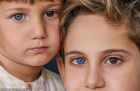 Brothers Are Born With Stunning Different Coloured Eyes In 2020 Different Colored Eyes Heterochromia Eyes Eyes