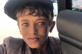 Ginger haired, blue eyed school boy. Yemeni Boy With Blue Eyes Abc News Australian Broadcasting Corporation