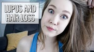 Hair loss 7 / 26 the symptoms of lupus tend to come and go, and this includes hair loss. Hair Loss And Hair Thinning From Discoid Systemic Lupus And Medication Youtube