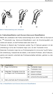 Rankings, courses, admissions, tuition fee, cost of attendance & scholarships. Neue Klassifikation Periprothetischer Frakturen Pdf Free Download