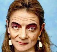 There Is A Kind Of Genetic Daughter Named Mr Bean She Thought She Was Ugly And Cute But She Was Moved After Seeing Her Face Daydaynews