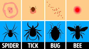 But mosquito bite hooman for reqson, for food. How To Identify A Bug Bite And What To Do With It Youtube