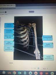 They ascend through the neck without branching before entering the cranium via the carotid canals. Lab 4 And 5 Blood Vessels Labeling Review Flashcards Quizlet