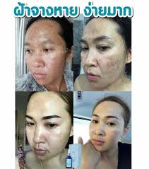 Check spelling or type a new query. à¸£ à¸§ à¸§à¸ˆ à¸² Cherlyn Serum à¹€à¸‹à¸£ à¸¡à¹€à¸Œà¸­à¸£ à¸¥ à¸™ Facebook