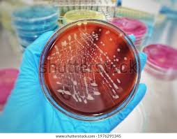 Image result for Rhodococcus equi
