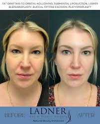 I wish I would have done this years ago with them” 🙏🏻 𝗣𝗔𝗧𝗜𝗘𝗡𝗧  𝗦𝗣𝗢𝗧𝗟𝗜𝗚𝗛𝗧 💫 @wildchildbree A heartfelt thank you to our wonderful  patient, Bre, for sharing her experience with us at