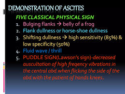 Image result for Puddle Sign