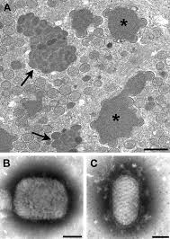 Last updated may 02, 2019. A Thin Section Image Of Raccoonpox Showing Viral Factories And Download Scientific Diagram