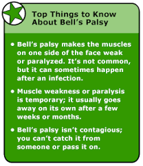 Bell's palsy can cause drooping or weakness on one side of your face. Https Encrypted Tbn0 Gstatic Com Images Q Tbn And9gctyzgycy5a3zurwvjix5a6yopphplke3uiw Q Usqp Cau