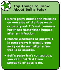 Bell S Palsy Your doctor may also run an imaging test, such as an mri or a ct scan, to make sure something like a tumor or bone fracture isn't pressing on your nerves. bell s palsy