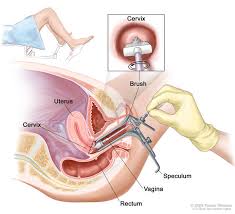 If you have a symptom or a screening test result that suggests cancer, your doctor must find out whether it is due to cancer or some other cause. How We Diagnose Cervical Cancer Dana Farber Cancer Institute Boston Ma